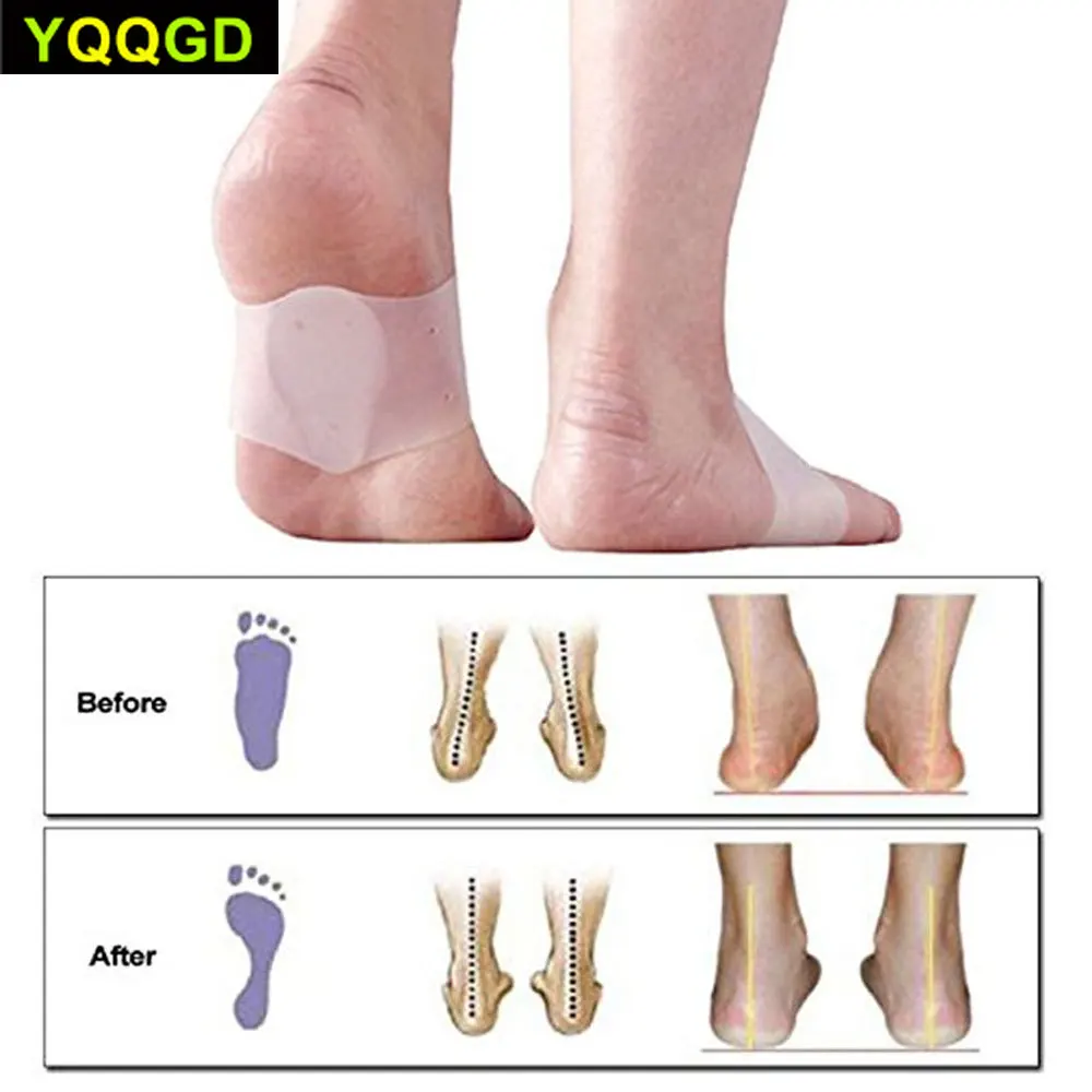 1 комплект амортизирующие рукава на пятке фиксатор арки выпрямитель для пальцев