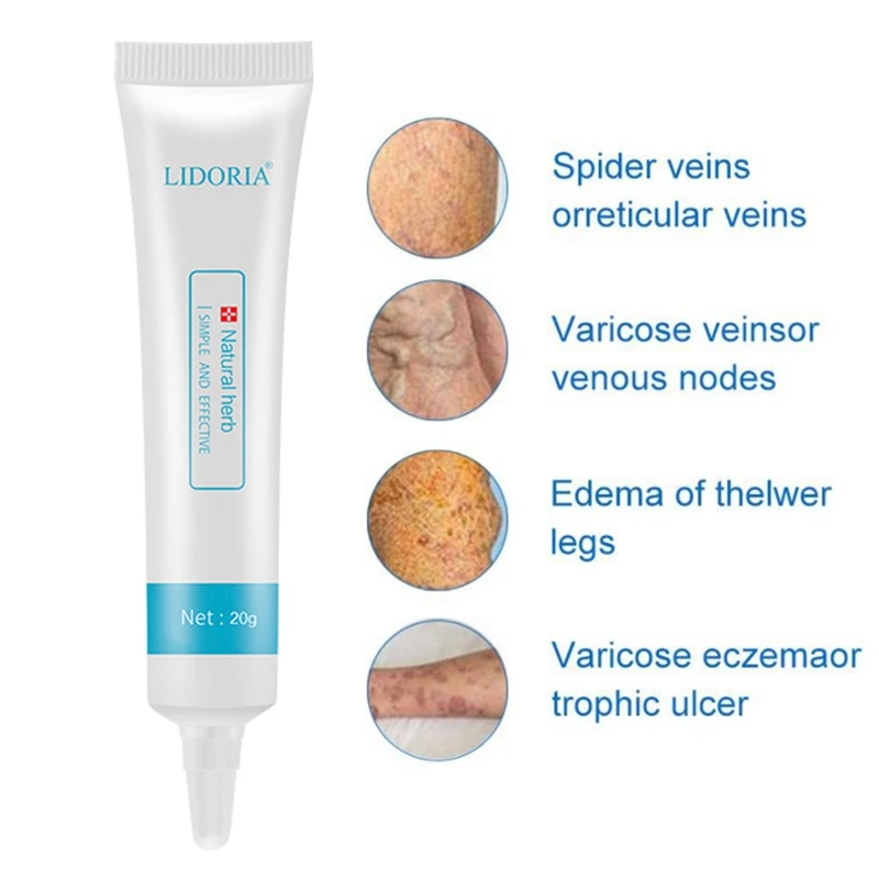 Varicose Veins Cream Promote Blood Circulation Relief Phlebitis Vasculitis Treatment Ointment Vessel Care |