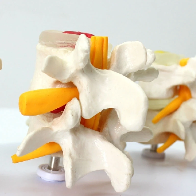 

Human Anatomy Skeleton Spine 4-Stages Lumbar Vertebral Model Brain Skull Traumatic Teaching Supplies