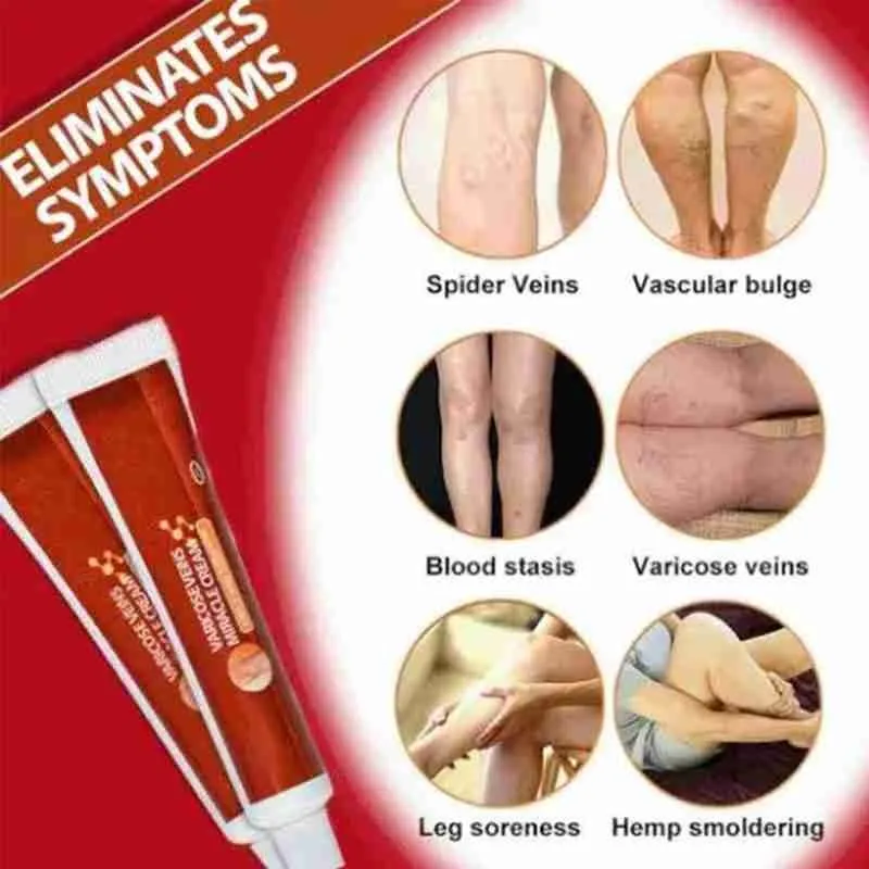 20 г мазь для варикозных вен васкулита флебит Паук Крем варикоза ангиит удаления