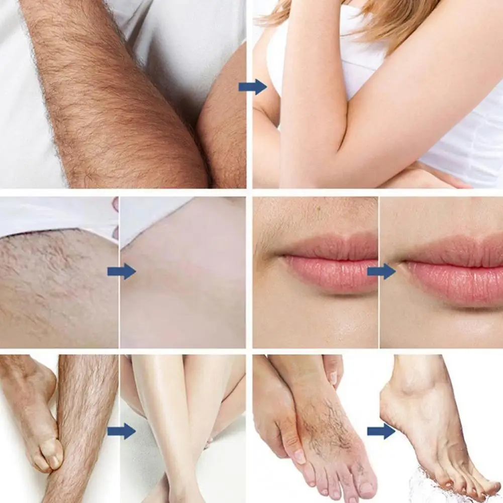 

Permanent Body Hair Removal Cream Mild Non-irritating Depilation Fresh Body Natural Painless Permanent Depilation Armpit M8B5