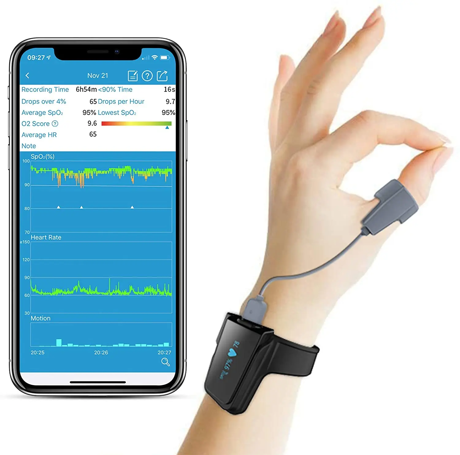 Монитор насыщения кислородом Viatom Checkme O2 Max измеритель уровня кислорода во время
