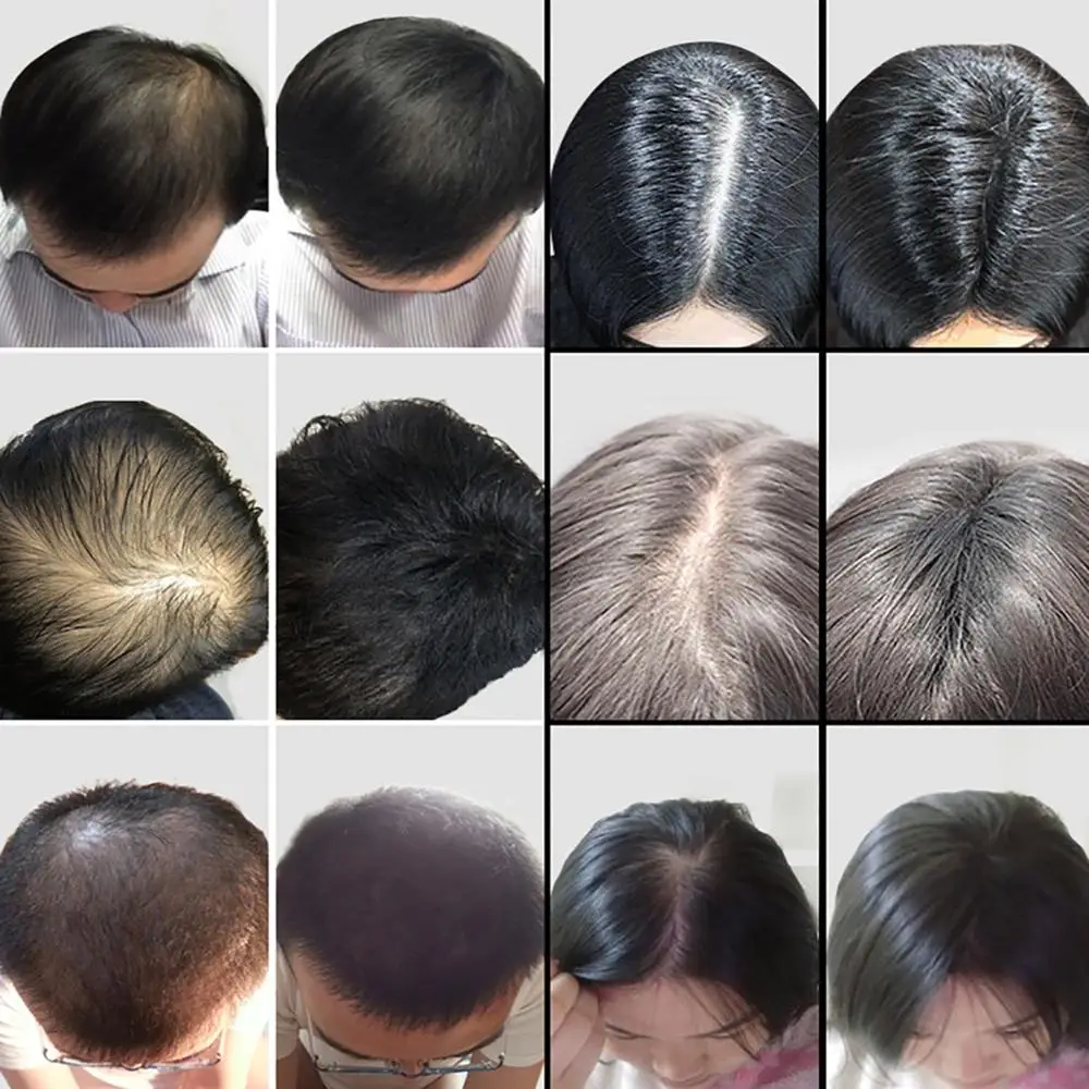 27 5 г волокна волос кератина утолщения спрей тема для от облысения выпадения