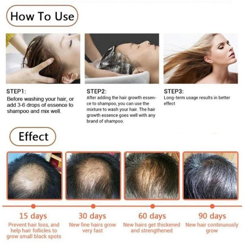 Эфирное масло для роста волос Восстановление сыворотка выпадения имбирное