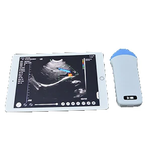 Рисунок 3 - Многоэлементный color192 выпуклый/линейный/Высокочастотный/микро