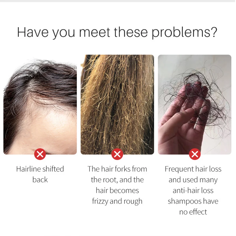 Hair Growth Serum Prevent Loss Fork Promote Regeneration Scalp Care Repair Deep Nourishment Oil Control Anti-Dandruff 30ml |