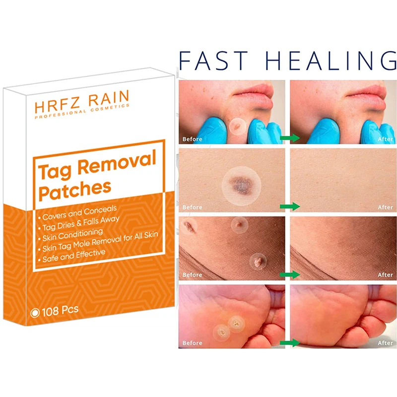 

108pcs Skin Tag Remover Acne Patch Wart Removal Patch Invisible Patch Stickers Remove Acne Cutaneous Skin Tags Relief Skin Care