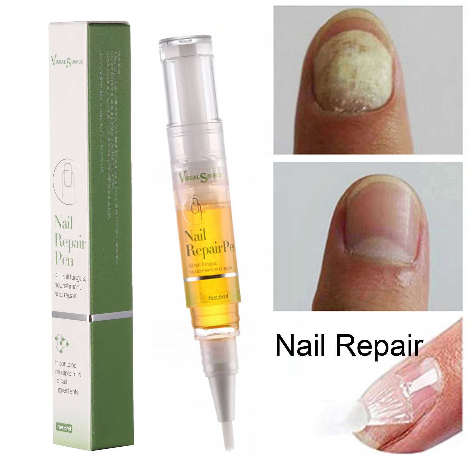 

Effective Fungus Removal Essence Oil Nail Liquid Repair Treatment Anti Infection Foot Caring Onychomycosis