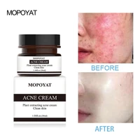 mopoyat acne treatment blackhead acne cream control oil shrink pores repair cream acne scar removal facial care whitening 30g