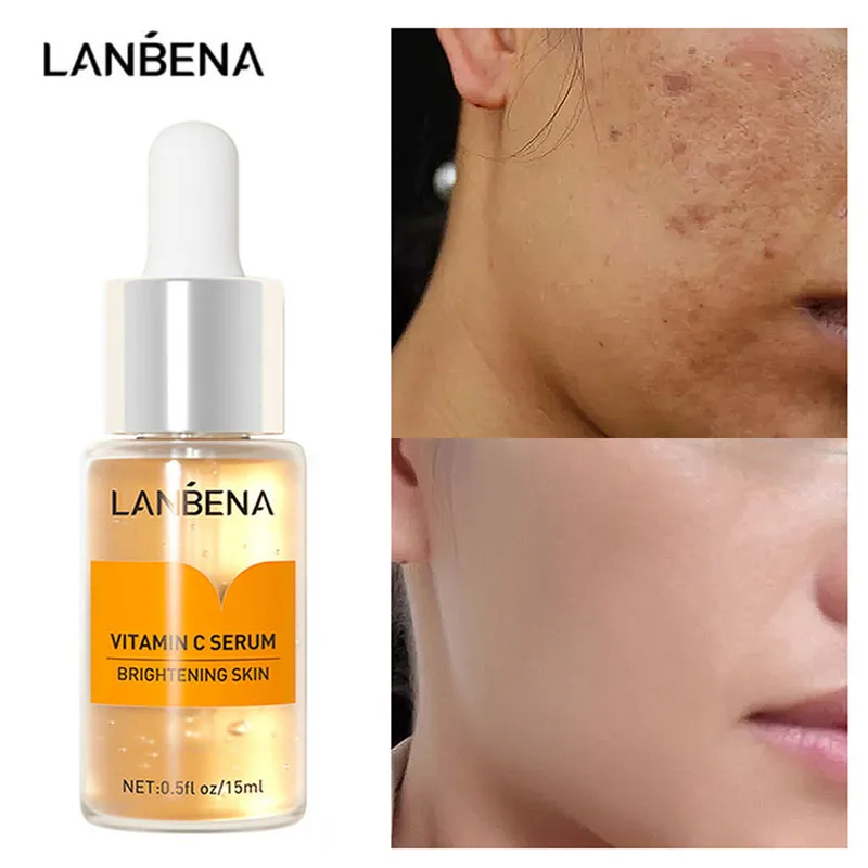 

LANBENA Vitamin C Whitening Serum Hyaluronic Acid Face Cream Snail Remover Freckle Speckle Fade Dark Spots Brighten Skin Care