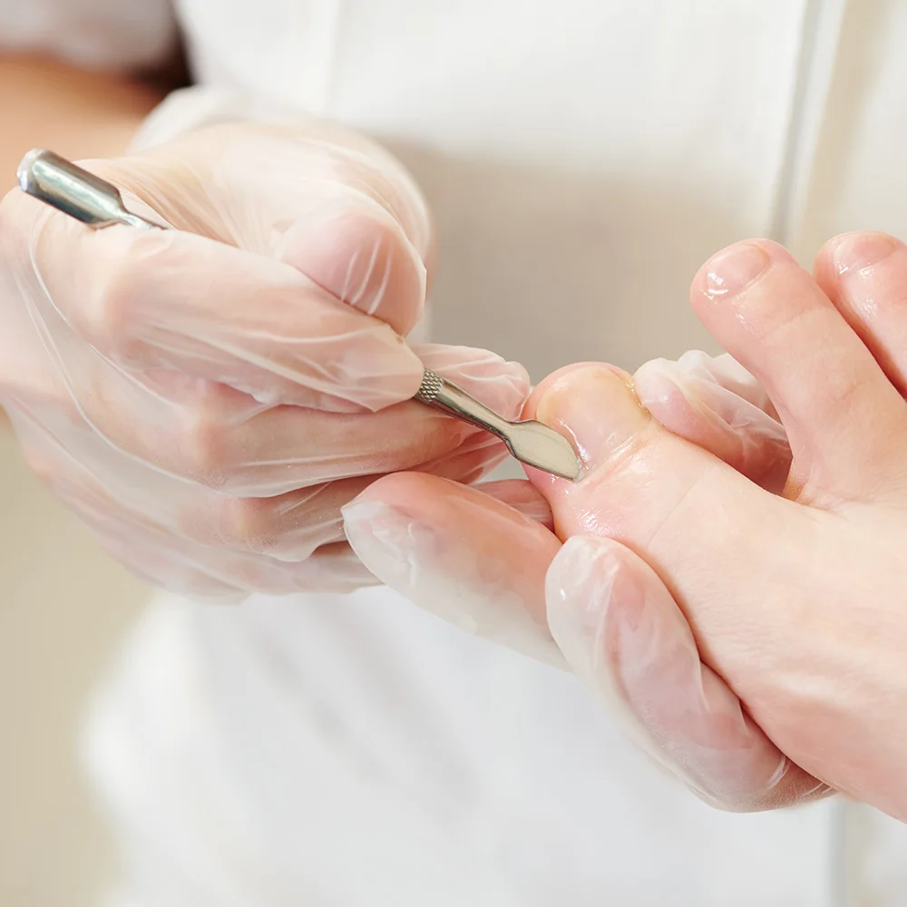 Инструменты для коррекции вросших пальцев пилочка ногтей набор выпрямления и