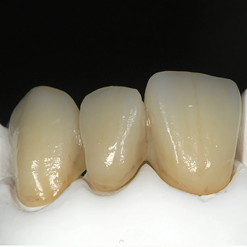 Ceradirect SHT-ML многослойная циркониевая система зацепа (95 мм)-для стоматологической