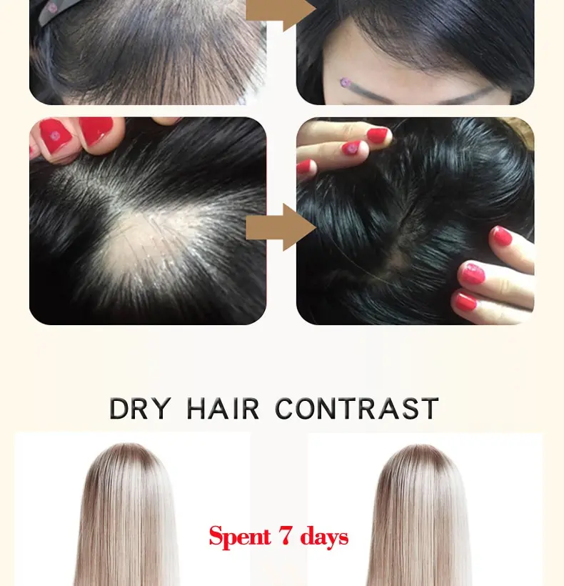 Полезная эссенция для ухода за волосами, марокканский женьшень, Кератиновое лечение облысения восстанавливающая сыворотка, порошок для роста волос для женщин и мужчин