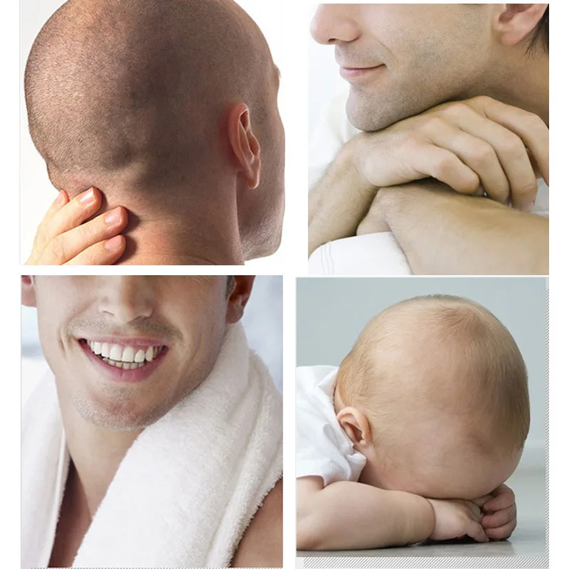 

Men's Self-service Hair Trimmer 360 Degree Rotatable Electric Clippers Bald Head Shaving Machine Usb Rechargeable