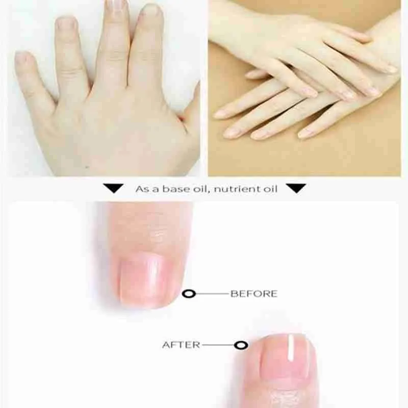 

1pcs Nail Nutrition Oil Dried Flowers Nail Care Oil Gel Polish Cuticle Nail Art Tool Anti-fungal Treatment Onychomycosis