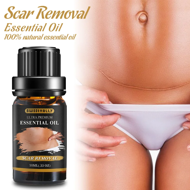 Эфирное масло 10 мл для беременных эфирное ухода за кожей без пятен |