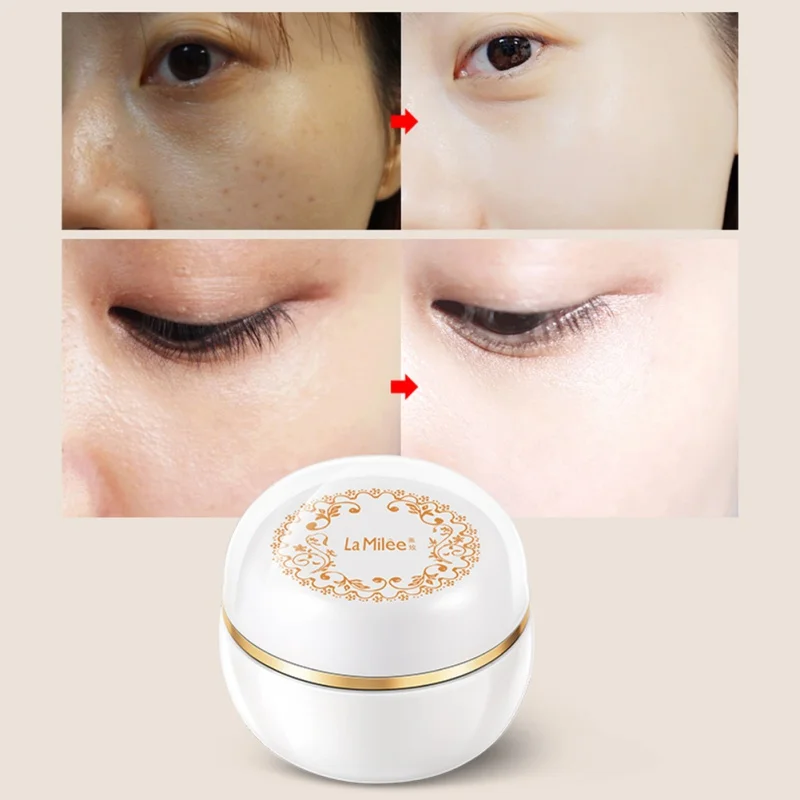 Новый волшебный женский крем для кожи обновление веснушки отбеливания веснушек