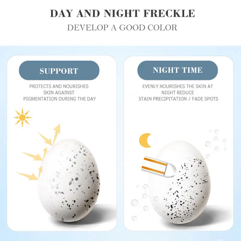 

30/60G Whitening Freckle Cream Remove Melasma Acne Spot Effective Pigment Melanin Dark Spots Pigmentation Moisturizing Skin Care