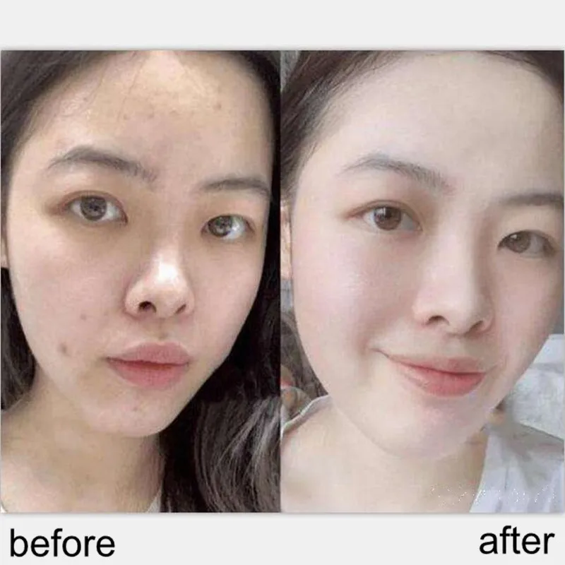 

Антисахаристые пятна dri ~ nk, отбеливание и Осветление ЛИЦА, улучшение темно-желтого цвета, защита от старения, сужение пор, 30 шт./коробка