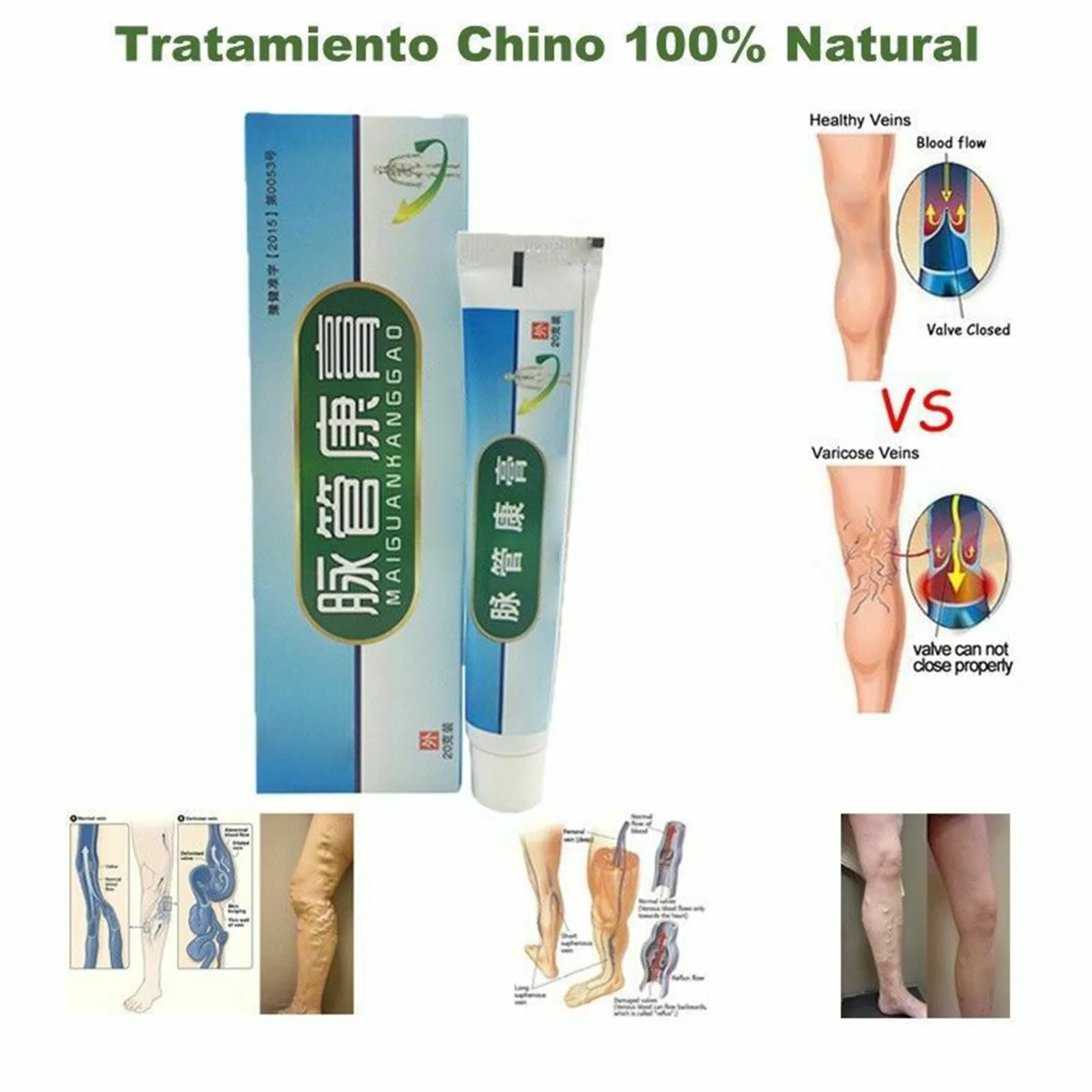 

Veins Cream Nature Herbal Cream Help To Relieve Varicose Veins Relieve the Pain in Your Legs M2