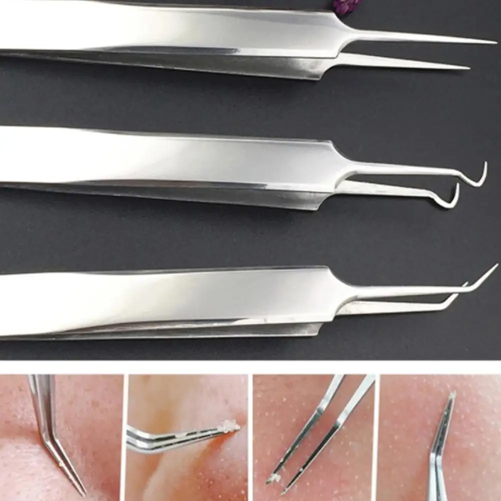 

steel face cleaner straight curve blackhead curve acne clip spine remover tweezers kit comedone E2V6