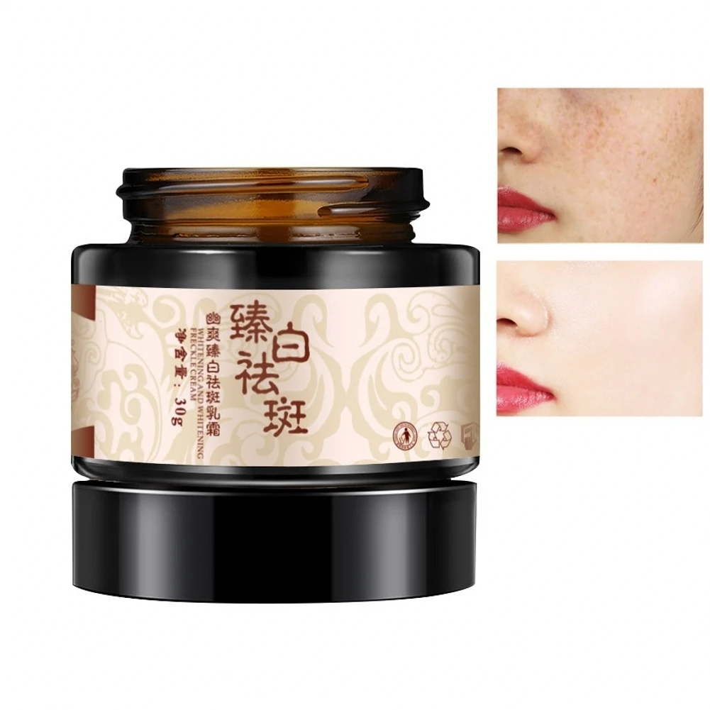 

30g Herbal Freckle Cream Whitening Freckle Chloasma Freckles Genetic Spot Sunburn Whitening Essence Freckle Cream