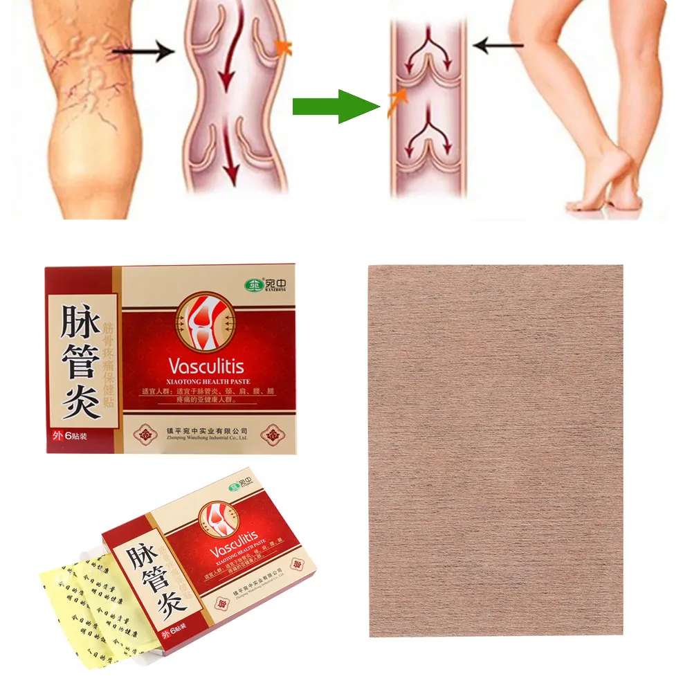 6 шт./кор. варикозное расширение вен натуральные китайские травяные заживляющие