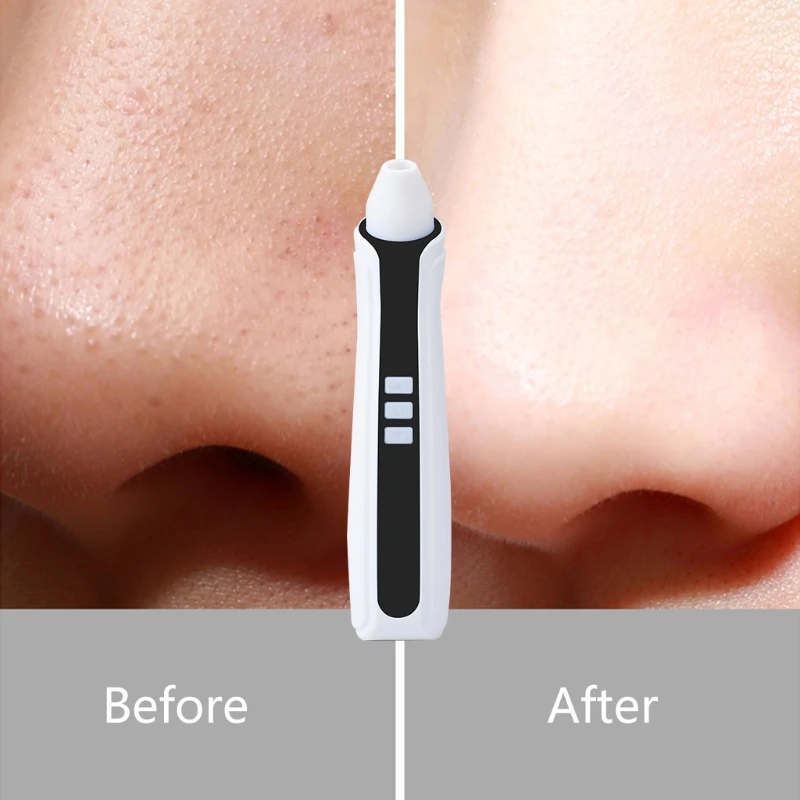 

Electric Pore Cleaner Smart Camera Visible Blackhead Remover Acne Comedones Vacuum Extractor Beauty Cleansing Instrument