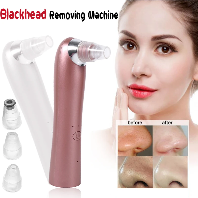 

Facial Blackhead Remover Skin Care Electric Acne Cleaner Pimple Removal Shrink Pores Machine USB Rechargeable Face Cleaner Tool