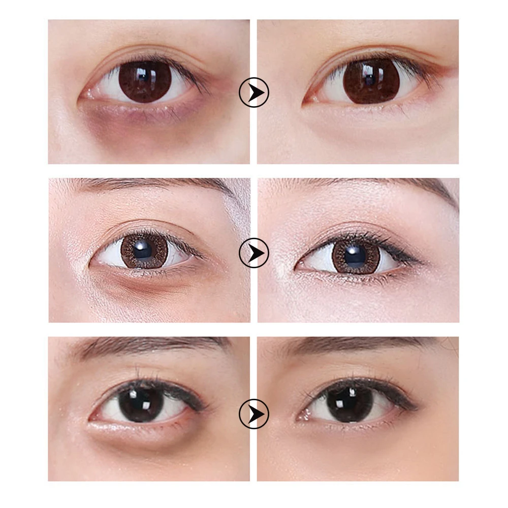 LANBENA маска для глаз с гиалуроновой кислотой сыворотка ретинола эссенция