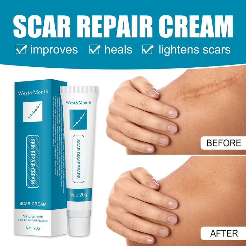 

Scar Cream 20g Skin Care for Both Old And New Scars Easy to Apply Scar Fading Make Scars Smaller & Less Visible Body Creams