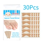 30 шт вросшие ногти для ног 