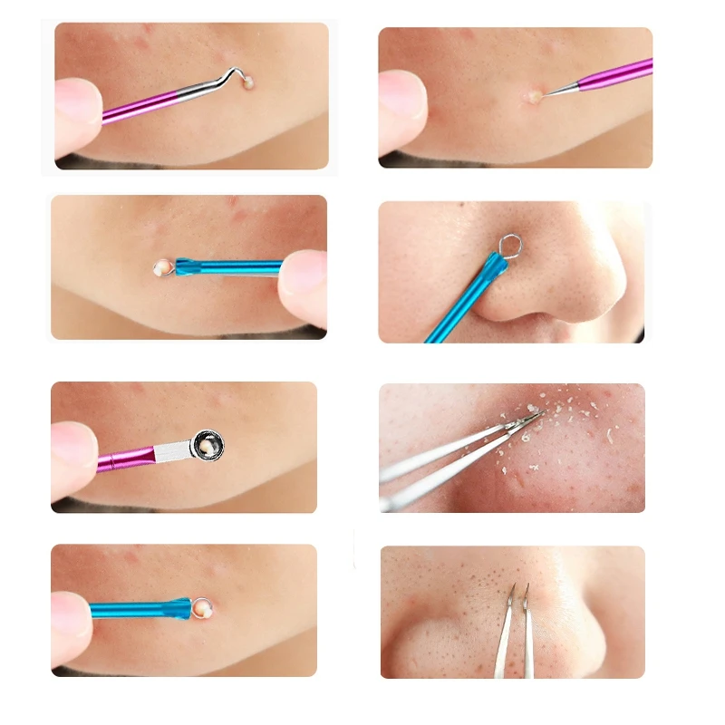 Acne Nose Blackhead Remover White Head Tool Pimple Removal Needle | Красота и здоровье