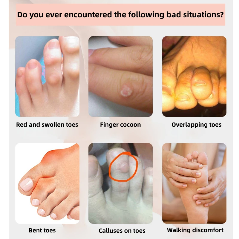 2/4/6/8 шт. силиконовые гелевые накладки на пальцы ног |