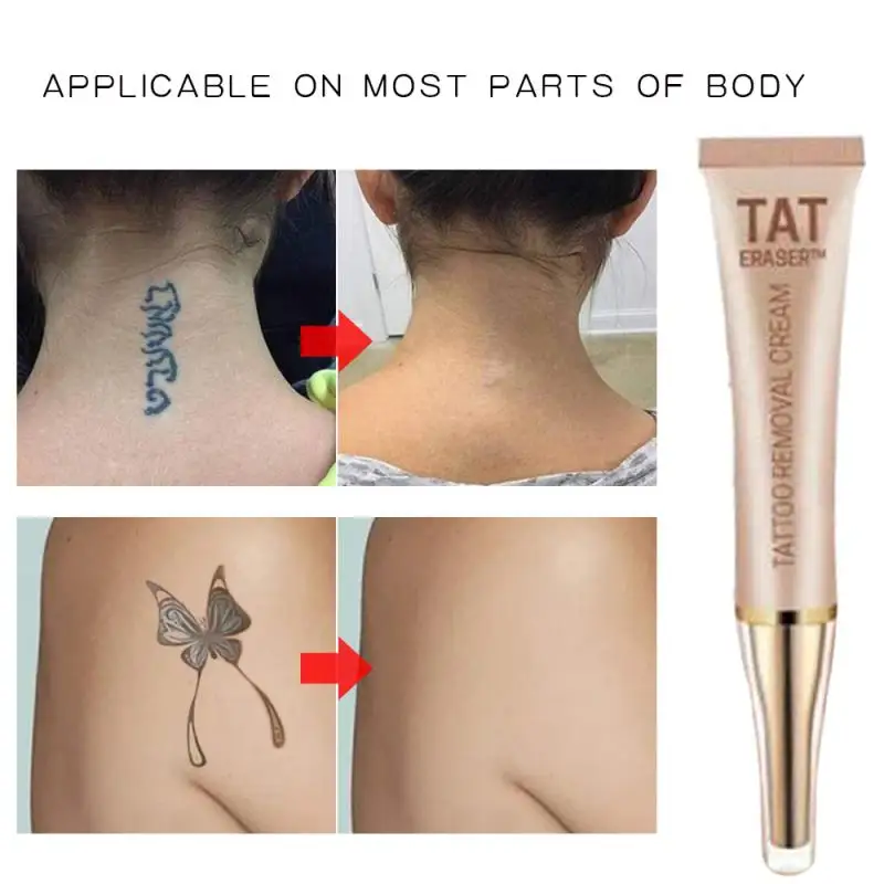 

1 Pcs Permanente Tattoo Verwijdering Creme Geen Behoefte Voor Pijn Verwijdering Maximale Sterkte Tattoo Accessoires