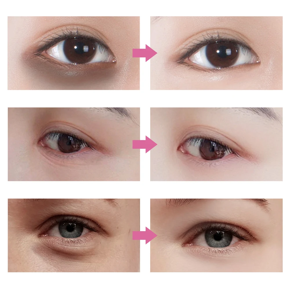 

Snail Essence Eye Cream Remove Dark Circles Whitening Moisturizing Anti-aging Wrinkle Snail Cream Skin Care