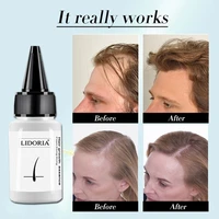 20ml fast hair growth serum anti preventing hair lose liquid damaged hair repair treatment eyelash eyebrow growing thick care