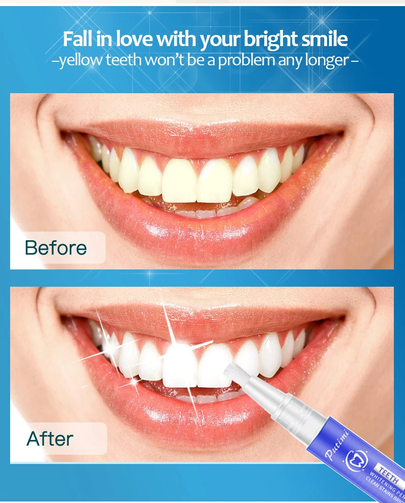 White Teeth Whitening Essence Pen Dental Tools Whitener Oral Hygiene White Tooth Cleaning Bleaching Serum Remove Plaque Stains