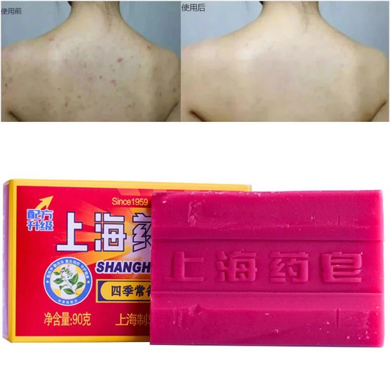 

Anti-mites Anti-acne Shanghai Medicinal Soap Body Cleansing Soap Skin Treatment Acne Psoriasis Seborrhea Eczema Anti Fungus