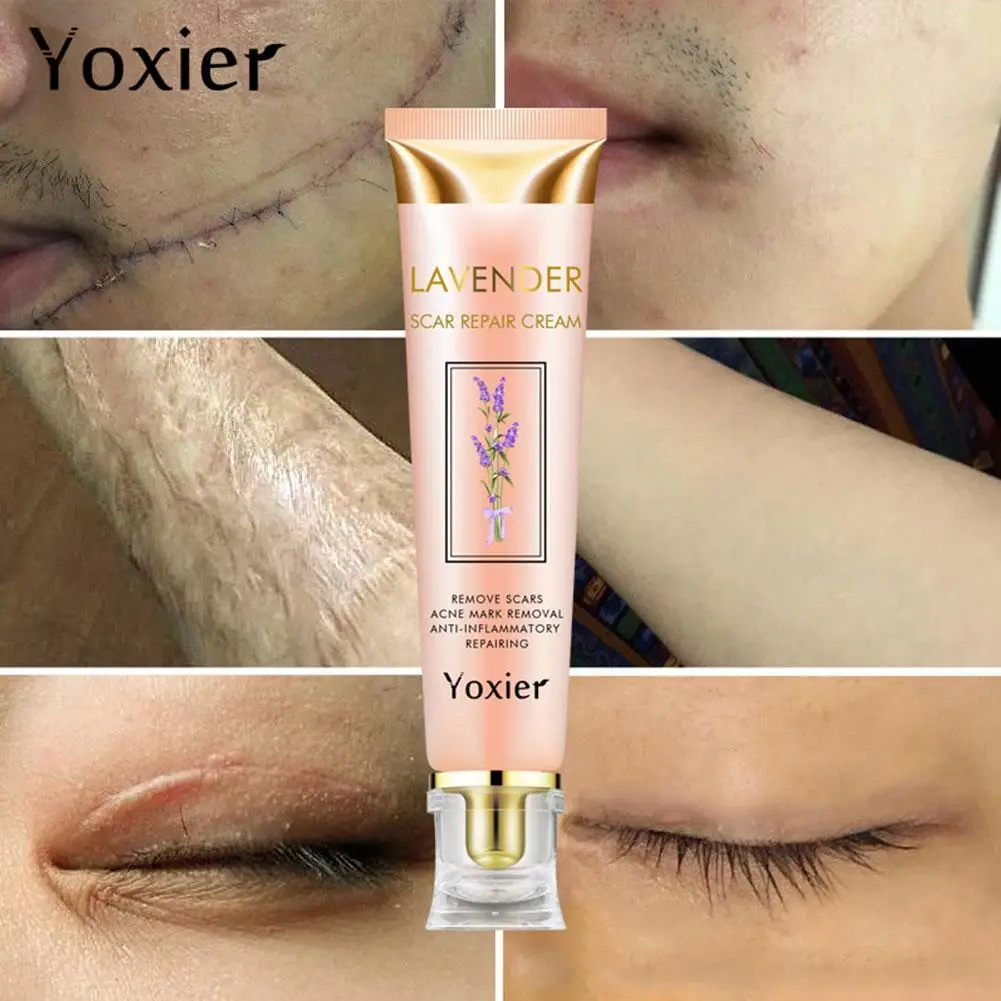 Восстанавливающий Крем Для рубцов с лавандой удаляет ожоги улучшает регенерацию
