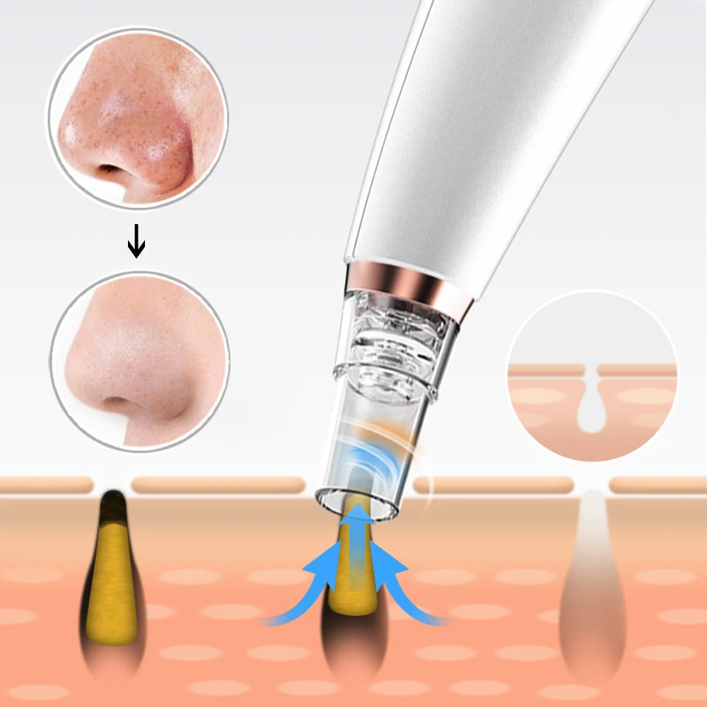 Средство для удаления черных точек средство глубокого очищения пор на лице ухода