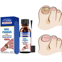 nail fungal treatment serum removal onychomycosis paronychia anti fungal nail infection toe fungus feet repair care essence 30g