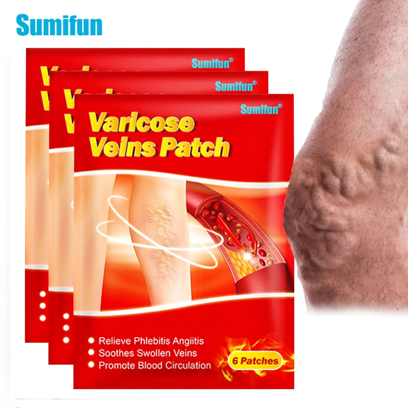 

6pcs Varicose Veins Patch Leg Vasculitis Phlebitis Spider Anti-swelling Angiitis Removal Chinese Herbal Medical Plaster K06201