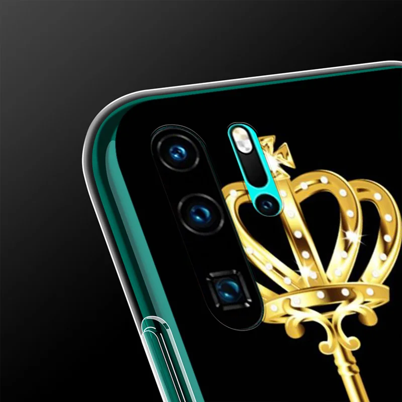 

King Queen Love For Honor X10 5G 10X 10i 10 9C 9S 9A 9i 9N 9X Pro 9 Lite Phone Case
