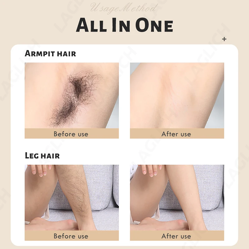 

999999 IPL Flashes Laser Epilator Permanent Photoepilator women Hair Removal depiladora Painless electric Epilator Dropshipping