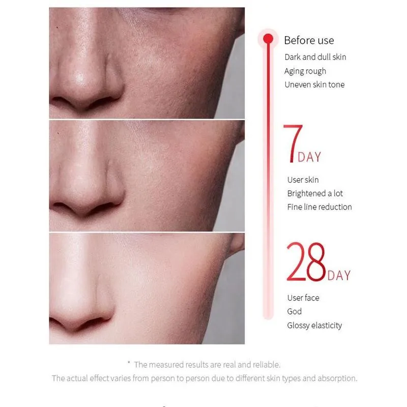 

15ml Nicotinamide Shrink Pores Face Serum Skin Repair Serum Hydration Anti-aging Acid Whitening Skin Hyaluronic Essence Car O1J6