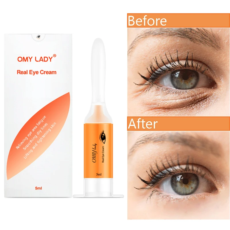 

5ml Eye Cream Anti Puffiness Instant Remove Dark Circles Eyes Serum Anti Aging Anti-wrinkle Moisturizing Skin Care Eyes Cream
