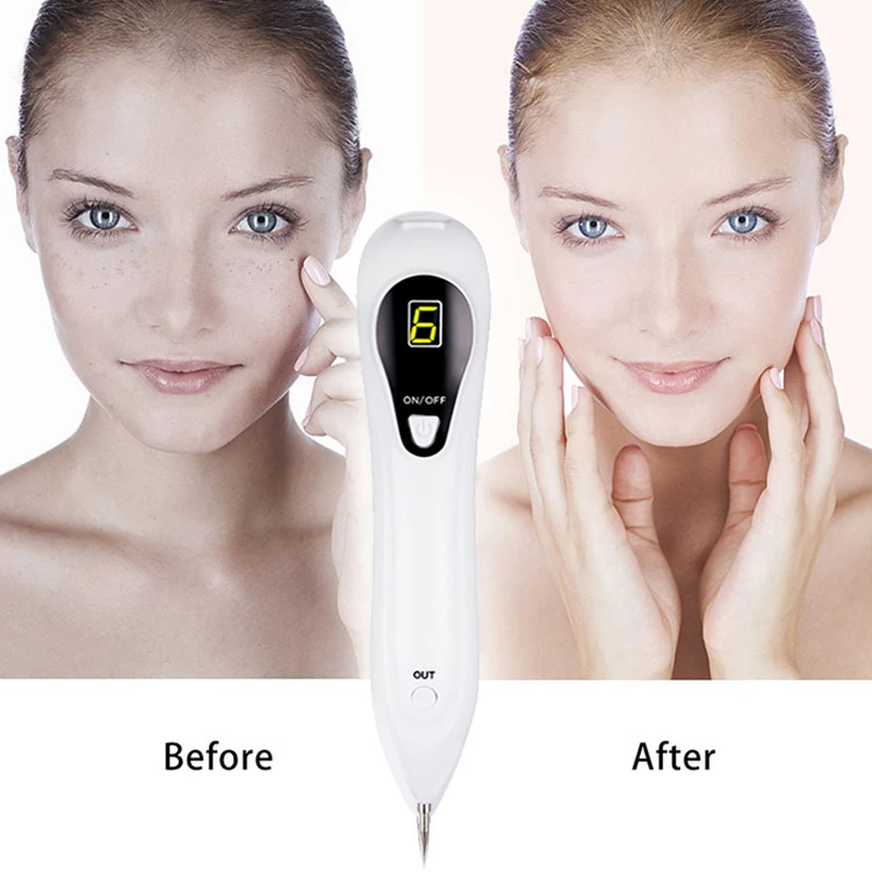 Инструмент для ухода за кожей инструмент удаления акне прыщей темных точек на