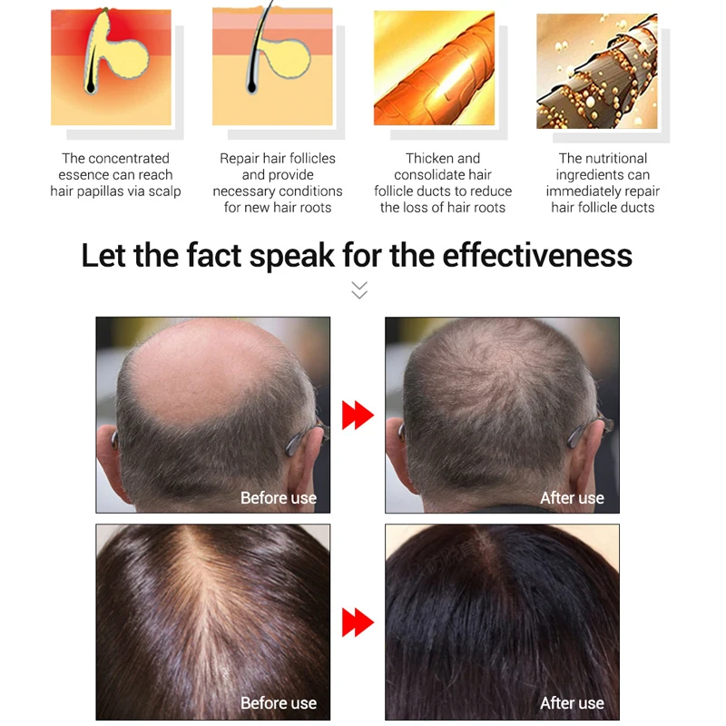 LANBENA быстро мощные средства с эссенцией для рост волос Эфирное Масло жидкое