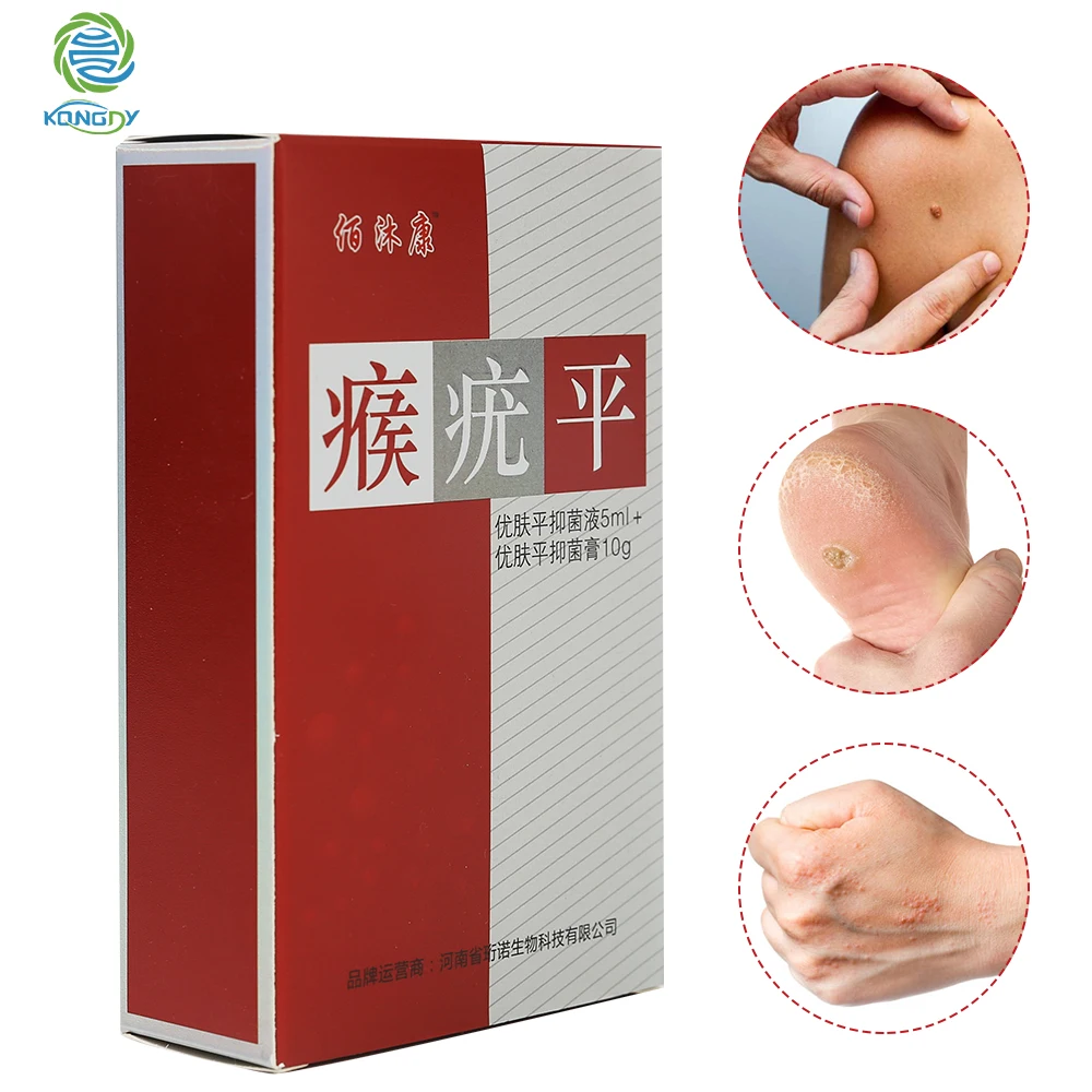 Крем для лечения бородавок KONGDY традиционный китайский патч удаления на ногах